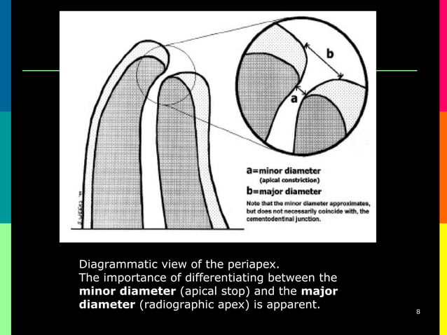 Endometrics root canal working length determination | PPT