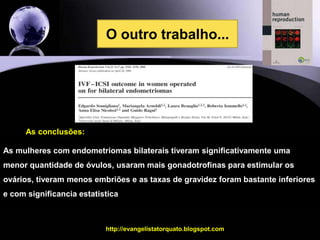 14O primeiro trabalho...As conclusões:Este trabalho comparou três grupos que fizeram fertilização in vitro:Pacientes com infertilidade tubáriaPacientes com endometrioma unilateral operadoPaciente com endometrioma bilateral operadoAs taxas de gravidez foram as mesmas nestes três grupos, embora o número de óvulos tenha sido menor nos ovários operados.http://evangelistatorquato.blogspot.com