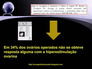 Podemos concluir que ...Podemos concluir que, coletivamente, estes estudos observacionais, demonstram que a resposta deste ovário afetado esta alterada. Embora a injúria possa ser mais quantitativa do que qualitativa, em alguns casos o insulto pode ser tão relevante que nenhum ou poucos óvulos  são recuperados.http://evangelistatorquato.blogspot.com16