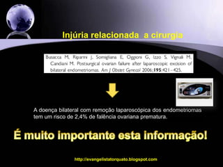 Injúria relacionada  a cirurgiahttp://evangelistatorquato.blogspot.com22  Cápsulas bem definidas  As paredes da cápsula raramente tem folículos ovarianos. É um TERATOMA  Pseudo cápsula  Normalmente as paredes da cápsula tem folículos – Teoria da invaginação.É um ENDOMETRIOMA.