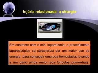 Injúria relacionada  a cirurgiahttp://evangelistatorquato.blogspot.com23A doença bilateral com remoção laparoscópica dos endometriomas tem um risco de 2,4% de falência ovariana prematura.É muito importante esta informação!