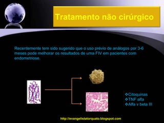 Tratamento não cirúrgicohttp://evangelistatorquato.blogspot.com28