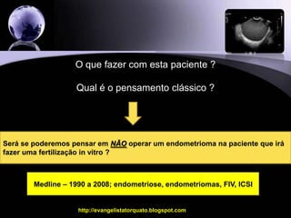 O que fazer com esta paciente ?Qual é o pensamento clássico ?Será se poderemos pensar em NÃO operar um endometrioma na paciente que irá fazer uma fertilização in vitro ?Medline – 1990 a 2008; endometriose, endometriomas, FIV, ICSIhttp://evangelistatorquato.blogspot.com3