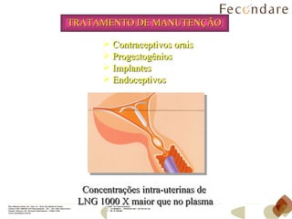 TRATAMENTO DE MANUTENÇÃO Concentrações intra-uterinas de LNG 1000 X maior que no plasma Contraceptivos orais Progestogênios Implantes Endoceptivos 