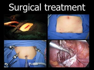 Surgical treatment 