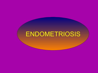 Endometriosis ENDOMETRIOSIS 