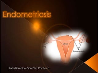 Endometriosis




 Karla Berenice González Pacheco
 