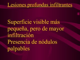 Lesiones profundas infiltrantes   Superficie visible más pequeña, pero de mayor infiltración  Presencia de nódulos palpables 