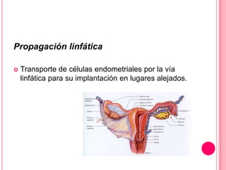 Propagación linfática


Transporte de células endometriales por la vía
linfática para su implantación en lugares alejados.

 