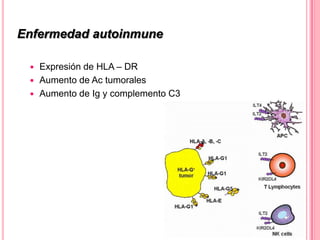 Enfermedad autoinmune
Expresión de HLA – DR
 Aumento de Ac tumorales
 Aumento de Ig y complemento C3


 
