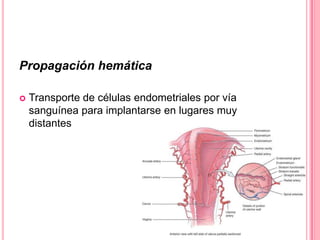 Propagación hemática
 Transporte de células endometriales por vía
sanguínea para implantarse en lugares muy
distantes
 
