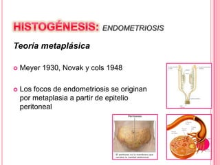 ENDOMETRIOSIS
Teoría metaplásica
 Meyer 1930, Novak y cols 1948
 Los focos de endometriosis se originan
por metaplasia a partir de epitelio
peritoneal
 