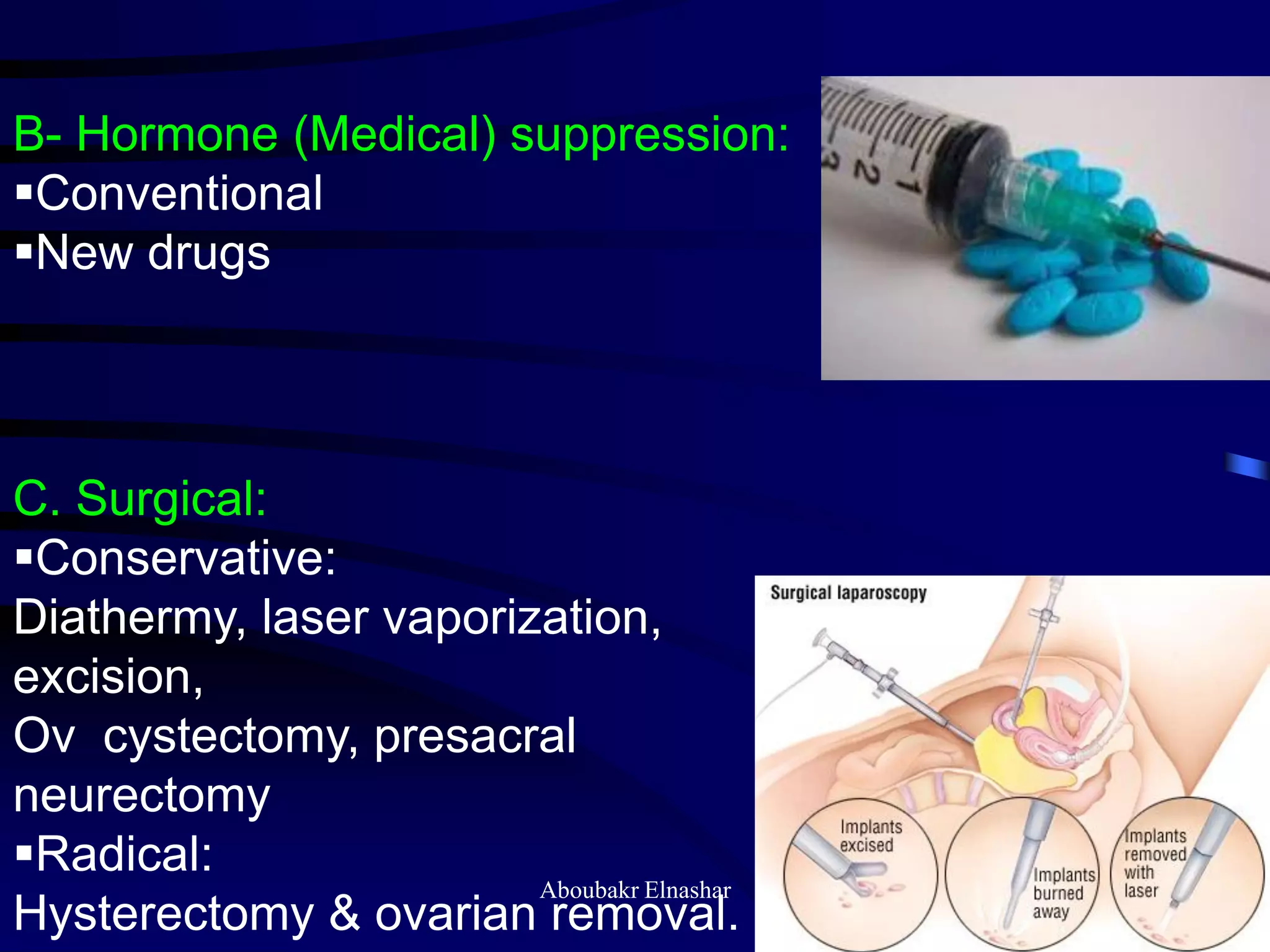 B- Hormone (Medical) suppression:
Conventional
New drugs
C. Surgical:
Conservative:
Diathermy, laser vaporization,
excision,
Ov cystectomy, presacral
neurectomy
Radical:
Hysterectomy & ovarian removal.
Aboubakr Elnashar
 