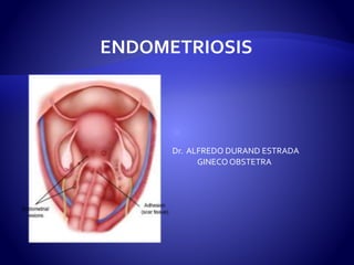 ENDOMETRIOSIS
Dr. ALFREDO DURAND ESTRADA
GINECO OBSTETRA
 