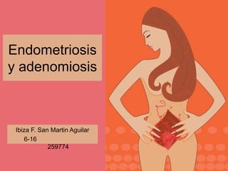 Endometriosis
y adenomiosis
Ibiza F. San Martin Aguilar
6-16
259774
 