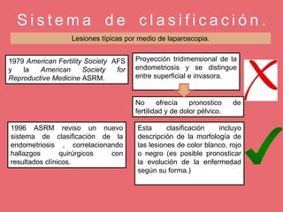 S i s t e m a d e c l a s i f i c a c i ó n .
Lesiones típicas por medio de laparoscopia.
1979 American Fertility Society AFS
y la American Society for
Reproductive Medicine ASRM.
Proyección tridimensional de la
endometriosis y se distingue
entre superficial e invasora.
No ofrecía pronostico de
fertilidad y de dolor pélvico.
1996 ASRM reviso un nuevo
sistema de clasificación de la
endometriosis , correlacionando
hallazgos quirúrgicos con
resultados clínicos.
Esta clasificación incluyo
descripción de la morfología de
las lesiones de color blanco, rojo
o negro (es posible pronosticar
la evolución de la enfermedad
según su forma.)
 