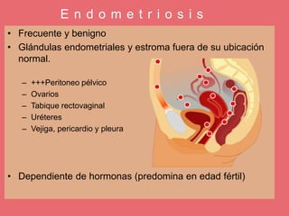 E n d o m e t r i o s i s
• Frecuente y benigno
• Glándulas endometriales y estroma fuera de su ubicación
normal.
– +++Peritoneo pélvico
– Ovarios
– Tabique rectovaginal
– Uréteres
– Vejiga, pericardio y pleura
• Dependiente de hormonas (predomina en edad fértil)
 