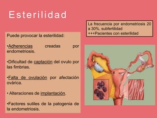 Esterilidad
La frecuencia por endometriosis 20
a 30%, subfertilidad
+++Pacientes con esterilidad
Puede provocar la esterilidad:
•Adherencias creadas por
endometriosis.
•Dificultad de captación del ovulo por
las fimbrias.
•Falta de ovulación por afectación
ovárica.
• Alteraciones de implantación.
•Factores sutiles de la patogenia de
la endometriosis.
 