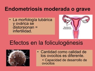Efectos en la foliculogénesis
• Cantidad como calidad de
los ovocitos es diferente.
< Capacidad de desarrollo de
ovocitos
• La morfología tubárica
y ovárica se
distorsionan =
infertilidad.
Endometriosis moderada o grave
 