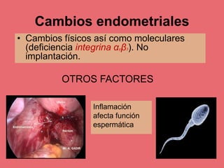 Cambios endometriales
• Cambios físicos así como moleculares
(deficiencia integrina αγβ3). No
implantación.
OTROS FACTORES
Inflamación
afecta función
espermática
 
