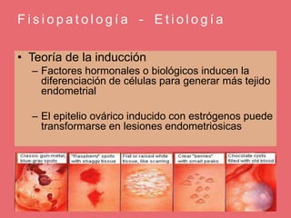 F i s i o p a t o l o g í a - E t i o l o g í a
• Teoría de la inducción
– Factores hormonales o biológicos inducen la
diferenciación de células para generar más tejido
endometrial
– El epitelio ovárico inducido con estrógenos puede
transformarse en lesiones endometriosicas
 