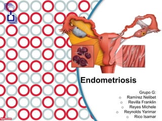 Endometriosis
Grupo G:
o Ramírez Nelibet
o Revilla Franklin
o Reyes Michele
o Reynolds Yarimar
o Rico Isamar
 
