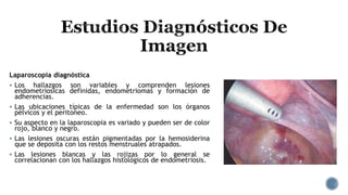 Laparoscopia diagnóstica
 Los hallazgos son variables y comprenden lesiones
endometriosicas definidas, endometriomas y formación de
adherencias.
 Las ubicaciones típicas de la enfermedad son los órganos
pélvicos y el peritoneo.
 Su aspecto en la laparoscopia es variado y pueden ser de color
rojo, blanco y negro.
 Las lesiones oscuras están pigmentadas por la hemosiderina
que se deposita con los restos menstruales atrapados.
 Las lesiones blancas y las rojizas por lo general se
correlacionan con los hallazgos histológicos de endometriosis.
 