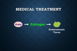 MEDICAL TREATMENT
Ovary Estrogen
Endometriosis
Tissue
 