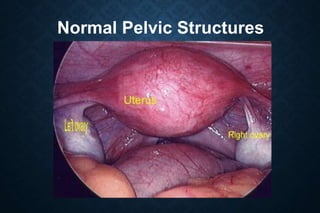 Normal Pelvic Structures
 