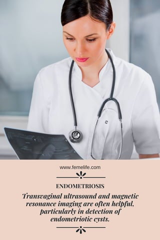 Transvaginal ultrasound and magnetic
resonance imaging are often helpful,
particularly in detection of
endometriotic cysts.
ENDOMETRIOSIS
www.femelife.com
 