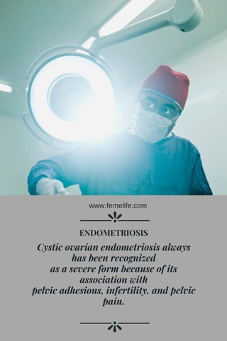 Cystic ovarian endometriosis always
has been recognized
as a severe form because of its
association with
pelvic adhesions, infertility, and pelvic
pain.
ENDOMETRIOSIS
www.femelife.com
 