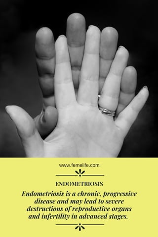 Endometriosis is a chronic, progressive
disease and may lead to severe
destructions of reproductive organs
and infertility in advanced stages. 
ENDOMETRIOSIS
www.femelife.com
 