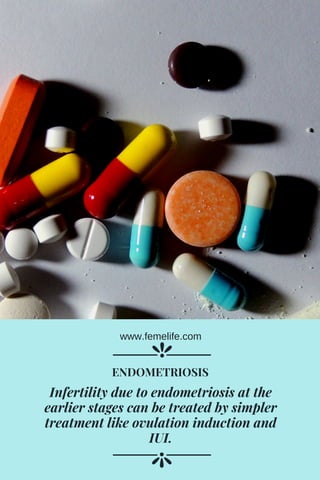 Infertility due to endometriosis at the
earlier stages can be treated by simpler
treatment like ovulation induction and
IUI.
ENDOMETRIOSIS
www.femelife.com
 