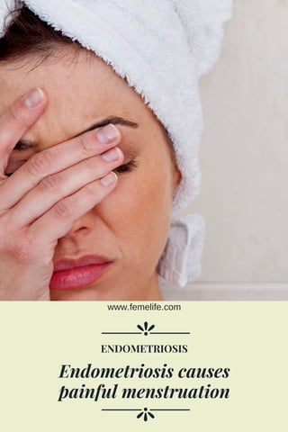 Endometriosis causes
painful menstruation
ENDOMETRIOSIS
www.femelife.com
 