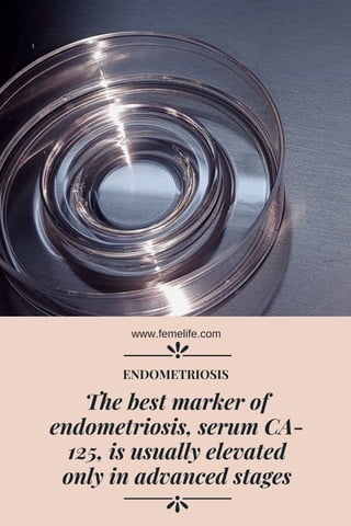 The best marker of
endometriosis, serum CA-
125, is usually elevated
only in advanced stages
ENDOMETRIOSIS
www.femelife.com
 
