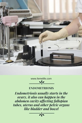 Endometriosis usually starts in the
ovary, it also can happen in the
abdomen cavity affecting fallopian
tubes, uterus and other pelvic organs
like bladder and bowel
ENDOMETRIOSIS
www.femelife.com
 