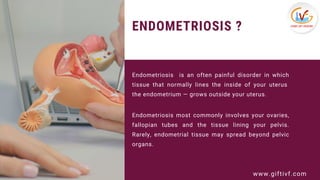 ENDOMETRIOSIS ?
Endometriosis  is an often painful disorder in which
tissue that normally lines the inside of your uterus ...