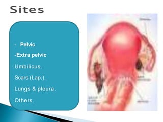 - Pelvic
-Extra pelvic
Umbilicus.
Scars (Lap.).
Lungs & pleura.
Others.
 
