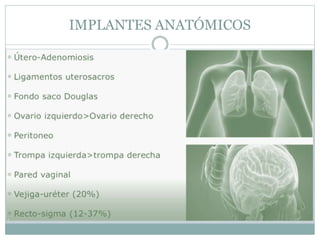 IMPLANTES ANATÓMICOS
 