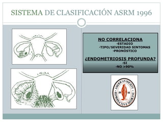 SISTEMA DE CLASIFICACIÓN ASRM 1996
 
