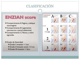 CLASIFICACIÓN
 