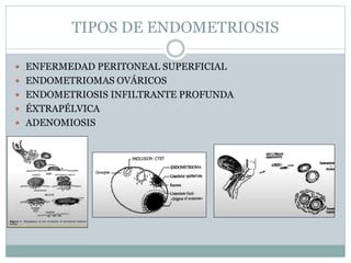 TIPOS DE ENDOMETRIOSIS
 ENFERMEDAD PERITONEAL SUPERFICIAL
 ENDOMETRIOMAS OVÁRICOS
 ENDOMETRIOSIS INFILTRANTE PROFUNDA
 ÉXTRAPÉLVICA
 ADENOMIOSIS
 