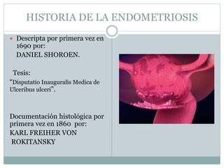 HISTORIA DE LA ENDOMETRIOSIS
 Descripta por primera vez en
1690 por:
DANIEL SHOROEN.
Tesis:
“Disputatio Inauguralis Medica de
Ulceribus ulceri”.
Documentación histológica por
primera vez en 1860 por:
KARL FREIHER VON
ROKITANSKY
 
