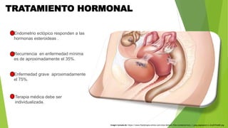 TRATAMIENTO HORMONAL
Endometrio ectópico responden a las
hormonas esteroideas .
Recurrencia en enfermedad mínima
es de apr...
