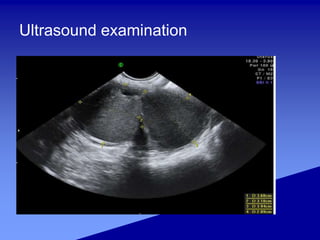 Ultrasound examination
 