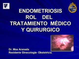 ENDOMETRIOSIS ROL  DEL  TRATAMIENTO  MÉDICO Y QUIRURGICO Dr. Max Araneda Residente Ginecología- Obstetricia. 