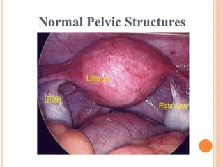 Normal Pelvic Structures
 