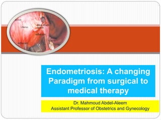 Dr. Mahmoud Abdel-Aleem
Assistant Professor of Obstetrics and Gynecology
Endometriosis: A changing
Paradigm from surgical to
medical therapy
 