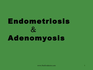 Endometriosis    ＆  Adenomyosis www.freelivedoctor.com 