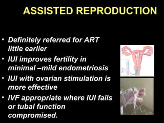 ASSISTED REPRODUCTION

• Definitely referred for ART
  little earlier
• IUI improves fertility in
  minimal –mild endometriosis
• IUI with ovarian stimulation is
  more effective
• IVF appropriate where IUI fails
  or tubal function
  compromised.
 
